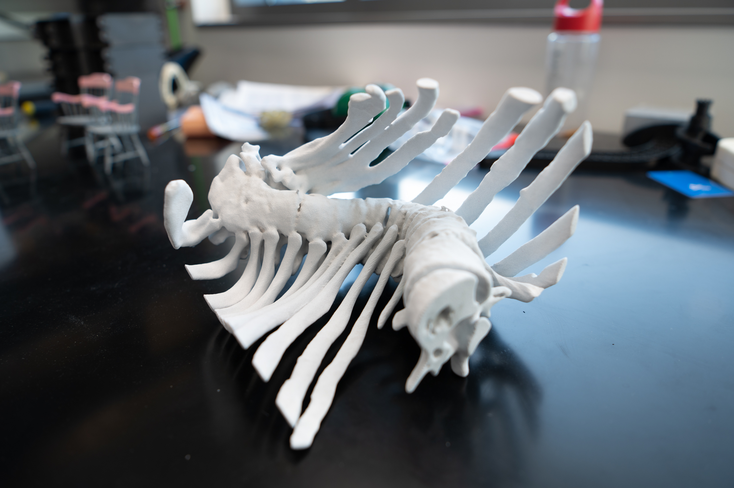 3D printed model of the spine of a patient with severe scoliosis.